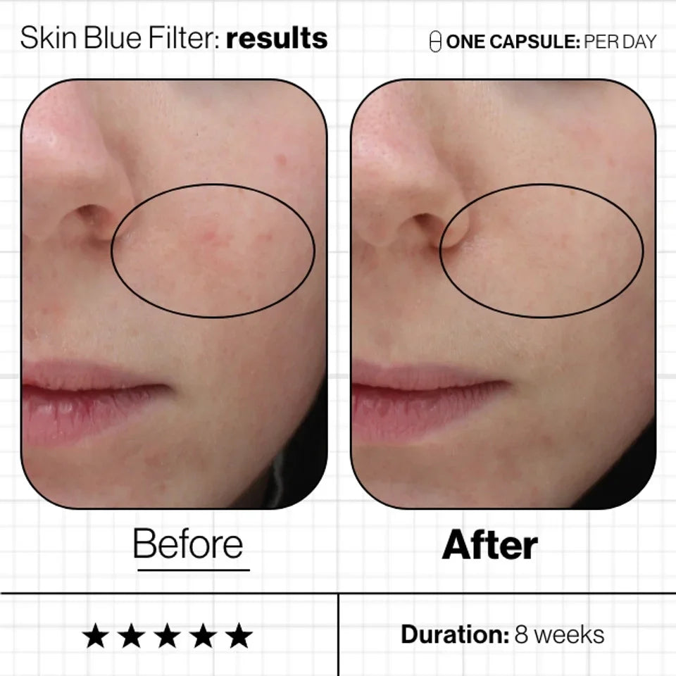 Skin Blue Filter image 2