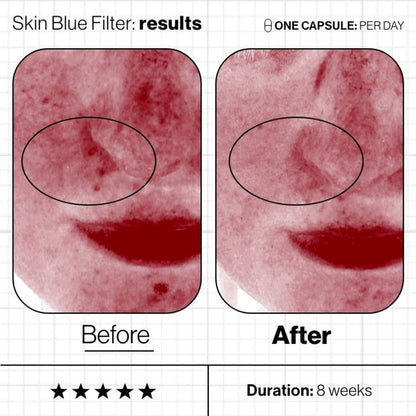 Skin Blue Filter image 4