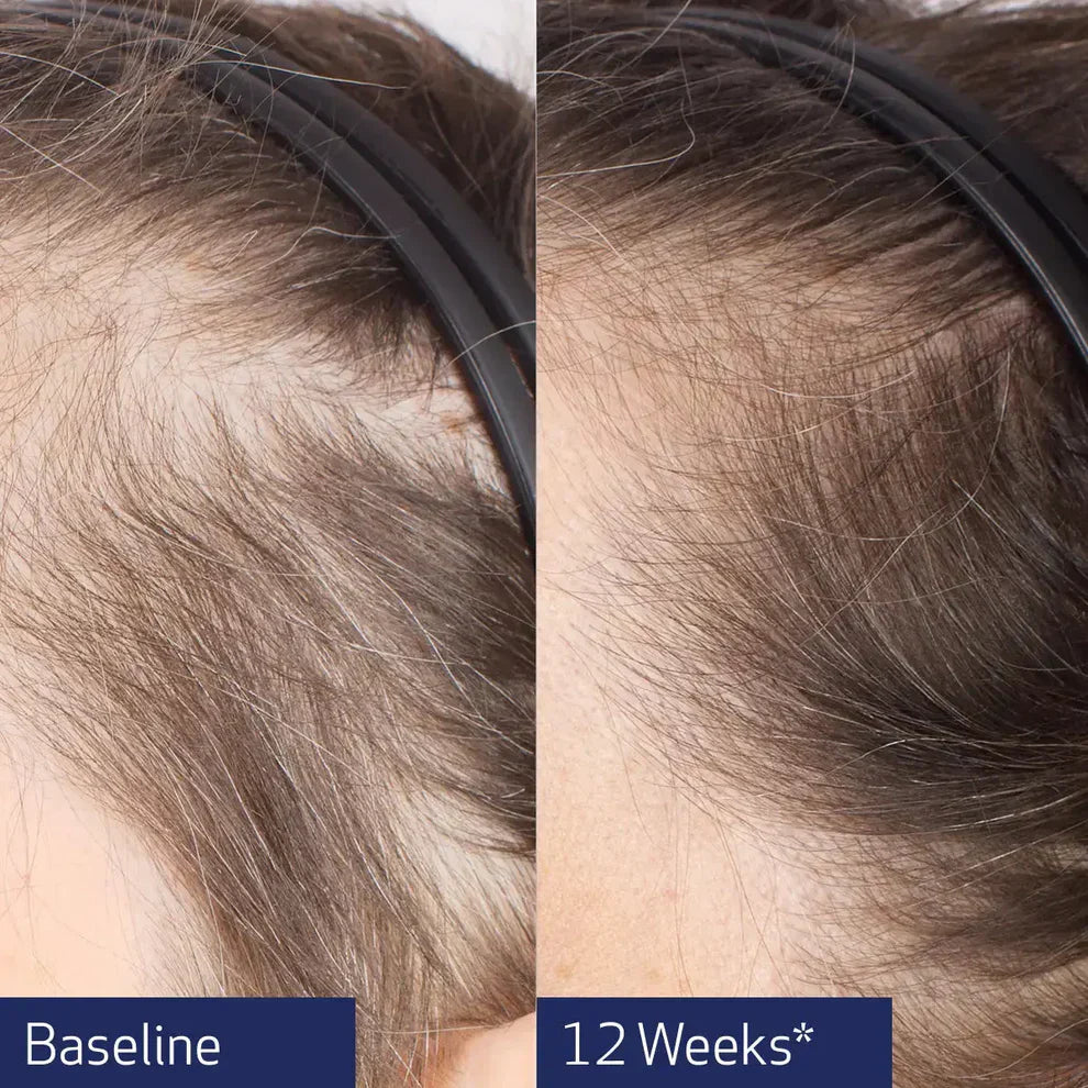 Obagi Nu-Cil® BioStim™ Scalp Serum 60ml image 4