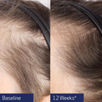 Obagi Nu-Cil® BioStim™ Scalp Serum 60ml image 4