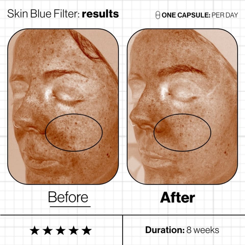 Skin Blue Filter image 3