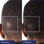 Obagi Nu-Cil® BioStim™ Scalp Serum 60ml image 5