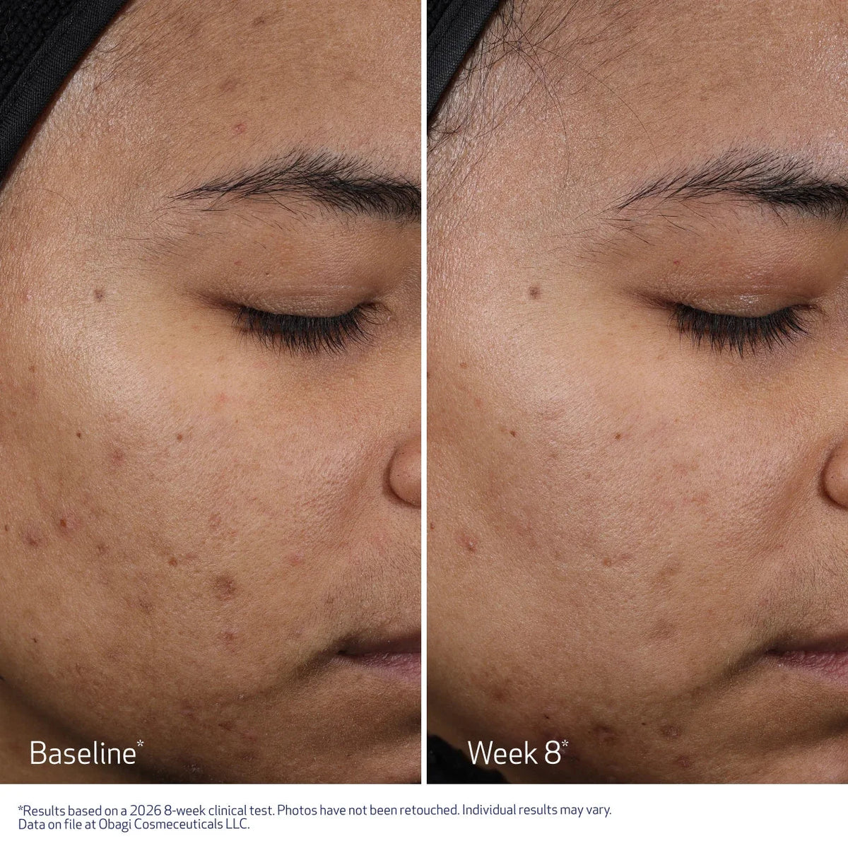 Obagi | CLENZIderm M.D. Resurfacing Multi Acid Peel Pads (30 Pads)