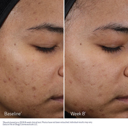 Obagi | CLENZIderm M.D. Resurfacing Multi Acid Peel Pads (30 Pads)