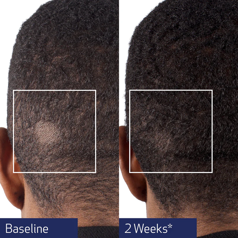 Obagi Nu-Cil® BioStim™ Scalp Serum 60ml